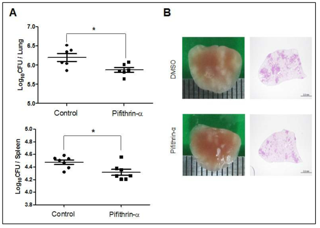 동물결핵균감염모델 Mtbk 감염 및 pifithrin-a 처리에 따른 폐와 비장에서의 결핵균수 및 pathological 변화