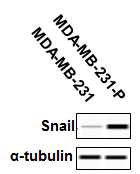 The comparison of MDA-MB-231 and the paclitaxel-resistant MDA-MB-231 cells (MDA-MB-231-P) in terms of Snail expression.