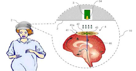 가천의과학대학교의 무선 전력 전송 방식의 심부 뇌자극 장치 개요도