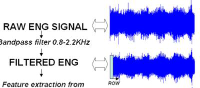조합된 ENG 활성신호의 잡음제거를 위한 필터링 기법