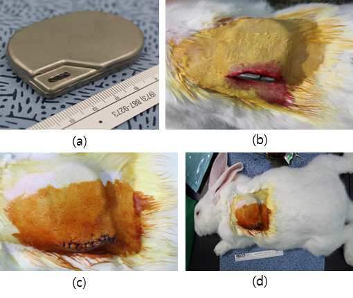 토끼 티타늄 캔 이식시 시술 사진: (a) 티타늄 캔 (b) 티타늄 캔 삽입 후 봉합 전 (c) 티타늄 삽입 후 봉합 (d) 티타늄 캔 삽입 후 봉합 전