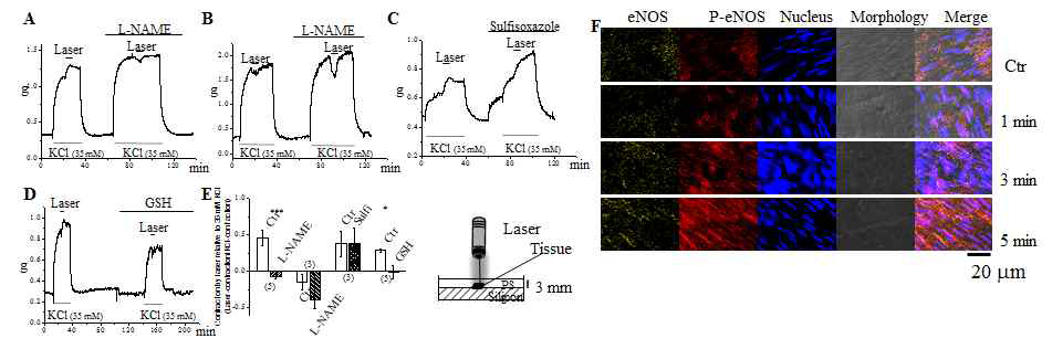 레이저에 의한 내피세포의 e-NOS의 인산화 확인, 항산화제에 의해 레이저에 의한 수축이 감소함