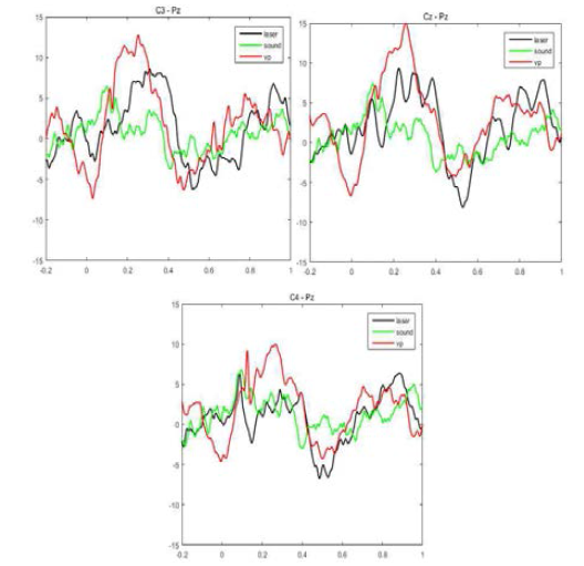 레이저 촉각(검정), 동역학적 촉각(빨강), 레이저 소리 자극(초록)에 대한 EEG 반응 패턴