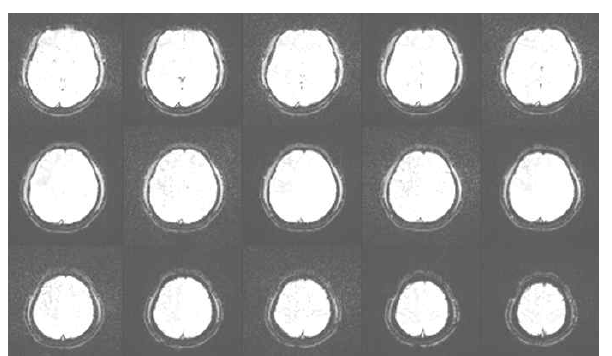 Human brain 영상에서 노이즈의 영향을 연속적으로 받은 모습