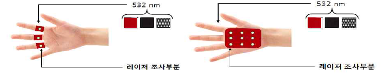 Ring type, Glove type 착용구 피험자 실험 결과