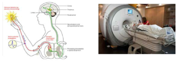 fMRI 연구분야의 적용 예시