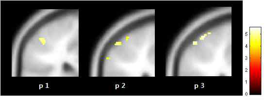 중지(d3)의 somatosensory cortex 영역 활성화