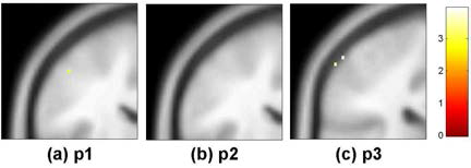 중지(d3)의 somatosensory cortex 영역 활성화