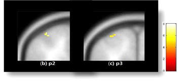 검지(d2)의 somatosensory cortex 영역 활성화