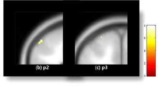 중지(d3)의 somatosensory cortex 영역 활성화