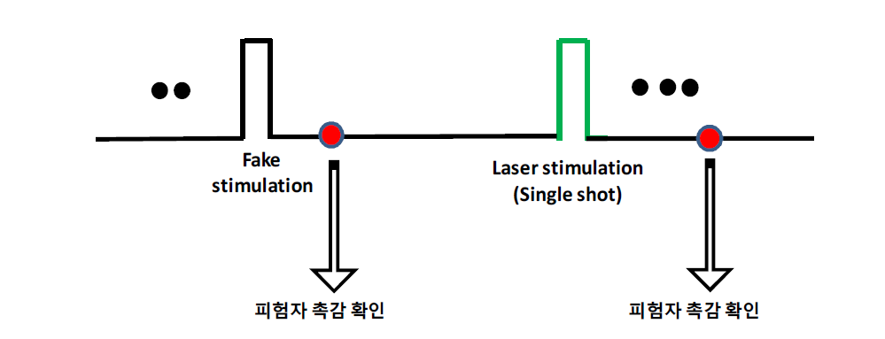 Single shot일 때, 레이저 자극 방법