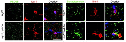 Microglia와 synapse 단백질 염색.