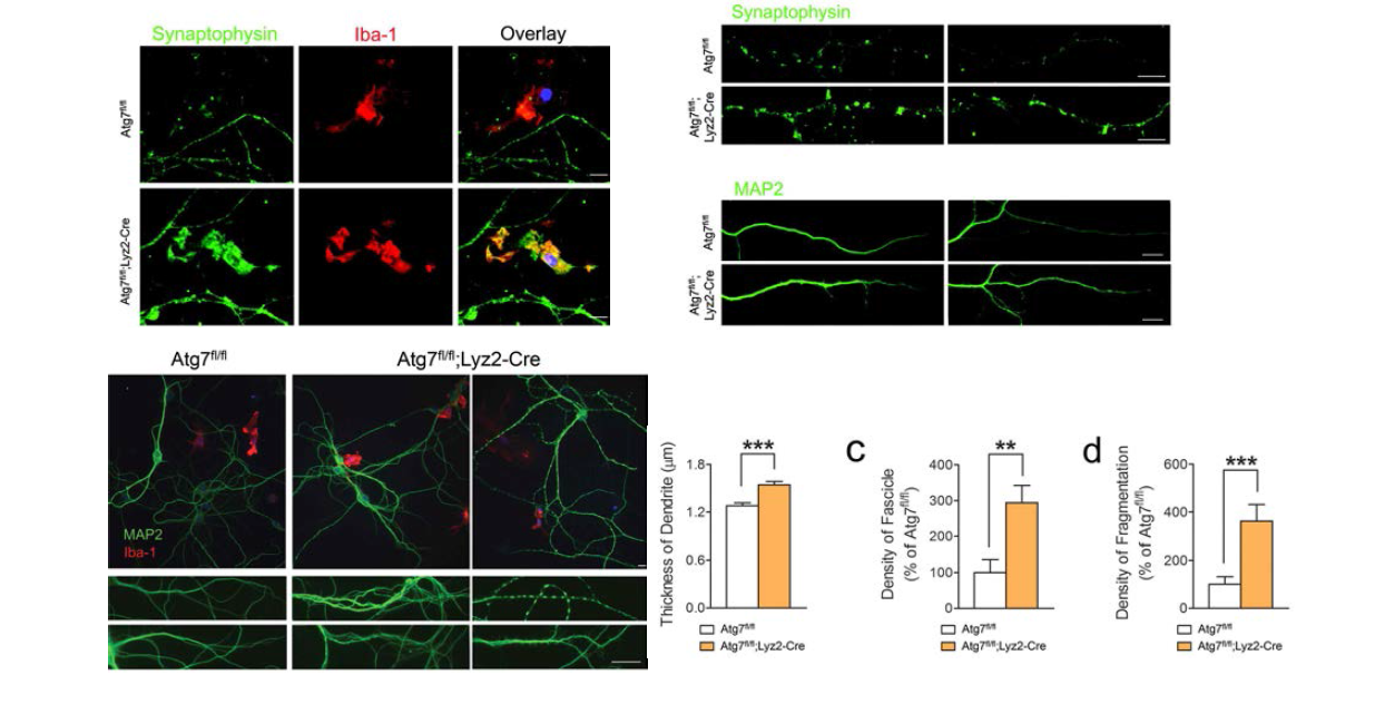 Neuron-Microglia 동시배양 후 신경세포 모습 관찰.