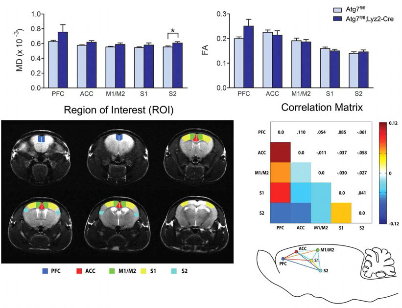 Atg7(fl/fl)와 Atg7(fl/fl)/LysM-cre mouse brain의 fMRI.DTI 촬영 그림.