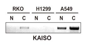 분획한 세포에서 KAISO 발현관찰 증가되어 있음을 관찰함. (그림 17)