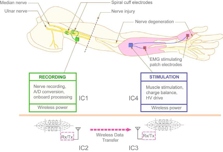 Singapore Institute of Neurotechnology팀의 신경인터페이스 개념도