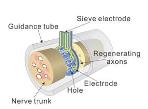 신경재생 전극