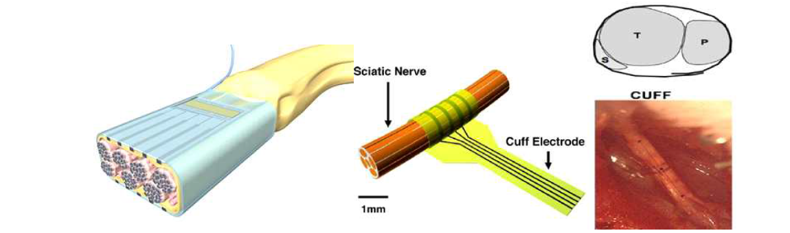 Extraneural 전극들의 예(왼쪽: http://www.dailytech.com/DARPA/Plugs/NextG, 중앙: https://www.researchgate.net/cuff-electrode, 오른쪽: Badia et al., 2011).