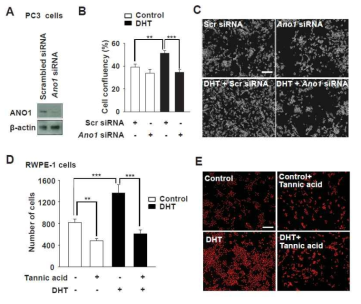 ANO1 siRNA 처치 혹은 길항제인 tannic acid 처치에 의한 ANO1 발현 억제