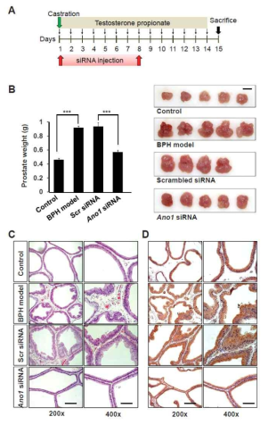 BPH rat model에서 ANO1 siRNA 투여에 의한 prostate weight 및 ANO1 발현의 변화
