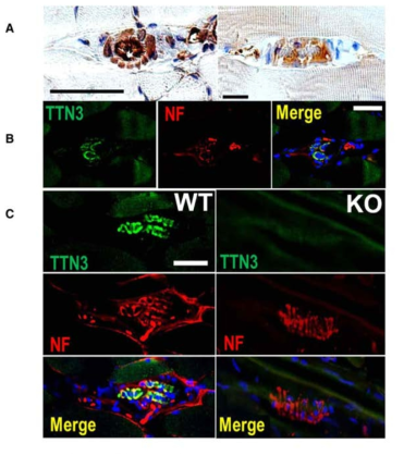 TTN3의 근육내 면역조직화학 및 형광 염색