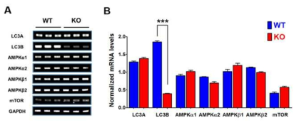 자가소화작용과 관련된 유전자들의 mRNA 양을 비교측정