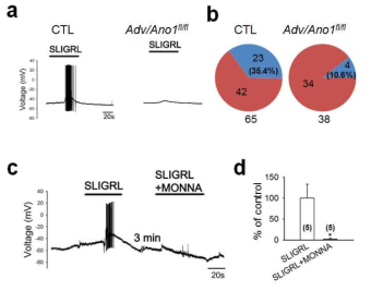 ANO1 mediates SLIGRL-induced excitation of DRG neurons.