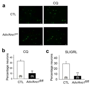 CQ- and SLIGRL-induced depolarization of DRG neurons isolated from CTL and Adv/Ano1fl/fl mice