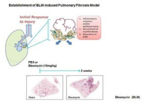 Bleomycin을 이용한 폐섬유화 마우스 모델 확립
