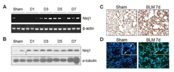 WT 마우스에 Bleomycin (BLM) 처리에 따른 Ninjurin1의 발현 변화