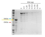 E. coli BL21 competent cell을 이용한 Ninjurin1 재조합 단백질 제작