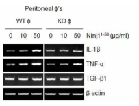 정상 마우스와 Ninjurin1 knockout 마우스의 복강 macrophage에 Ninjurin1 재조합단백질 (Ninj11-50) 처리에 따른 염증 cytokine의 발현 변화