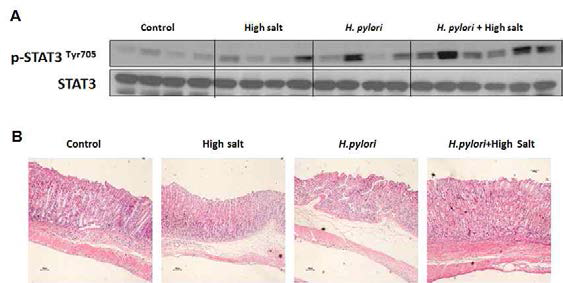 H.pylori 감염과 고염식이로 유도된 마우스 위염 모델에서 STAT3 인산화 증가