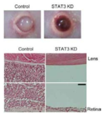 망막모세포종 동물모델에서 STAT3의 조절을 통한 종양억제 효과