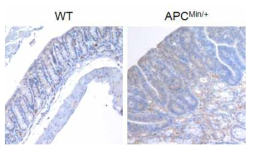 WT 마우스와 APCMin/+ 마우스의 대장에서 Ninjurin1 단백질 발현 조직학적 분석