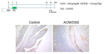Control과 AOM/DSS 처리 마우스의 대장에서 Ninjurin1 단백질 발현 조직학적 분석