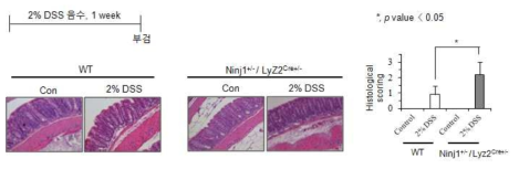 정상 마우스와 Ninjurin1/Lyz2Cre 마우스에서 대장염 발생 차이 조직학적 분석