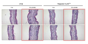 정상 마우스와 Ninjurin1 과발현 마우스간 TPA에 의한 염증반응 차이