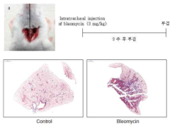 마우스에서 Bleomycin을 이용한 폐섬유화 모델 확립