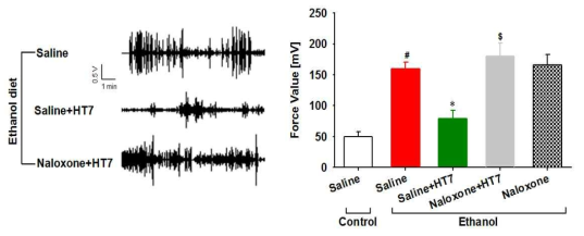 신문혈 자극을 통한 알코올 금단에 의해 유도된 진전(tremor)억제에 대한 naloxone의 효과