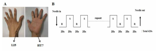 (A) 신문혈(HT7)과 양계혈(LI5). (B) fMRI 실험 패러다임