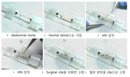 제작된 Flexible 마이크로 니들을 이용한 토끼 복부대동맥 마이크로니들 장착 ex vivo형태 동물실험 개념도