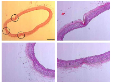 Flexible 마이크로니들의 ex-vivo 실험을 진행한 토끼 복부대동맥의 H&E 이미지.