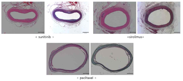 혈관내막이상증식 방지 약물인 Paclitaxel(PTx)/ Sirolimus(SRL)/Sunitinib이 전달된 토끼 복부 대동맥의 H&E 및 pentachrome 조직병리 이미지.