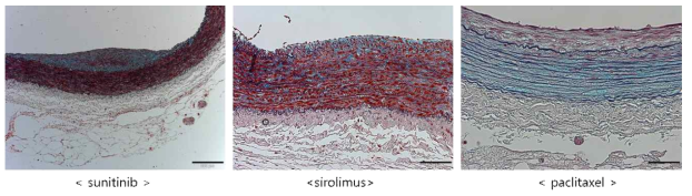 혈관내막이상증식 방지 약물인 Paclitaxel(PTx)/ Sirolimus(SRL)/Sunitinib이 전달된 토끼 복부 대동맥의 pentachrome 조직병리 확대 이미지.