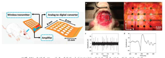 유연한 film 상에 제작된 마이크로니들 센서의 체내 신호 센싱 적용 사례