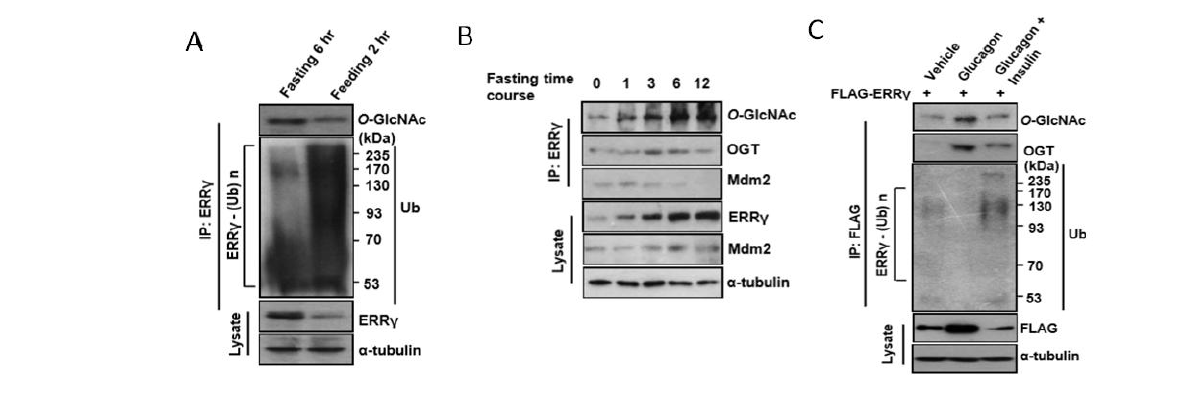 Glucagon에 의한 ERRgamma O-GlcNAcylation