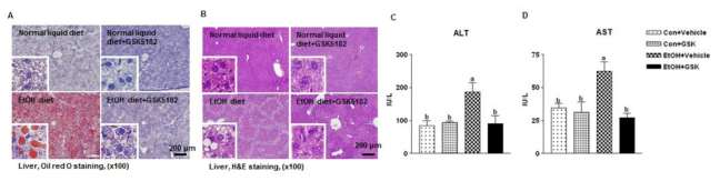 GSK5182에 의한 알코올성 지방간 억제 효과