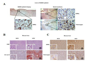 비알콜성 지방간 환자와 고지방식 다이어트 쥐의 간에서의 ERRgamma와 fibrinogen의 유전자 발현