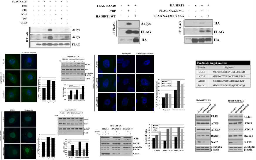 Sirt1에 의한 Naa20 조절기전 및 오토파지 연관성